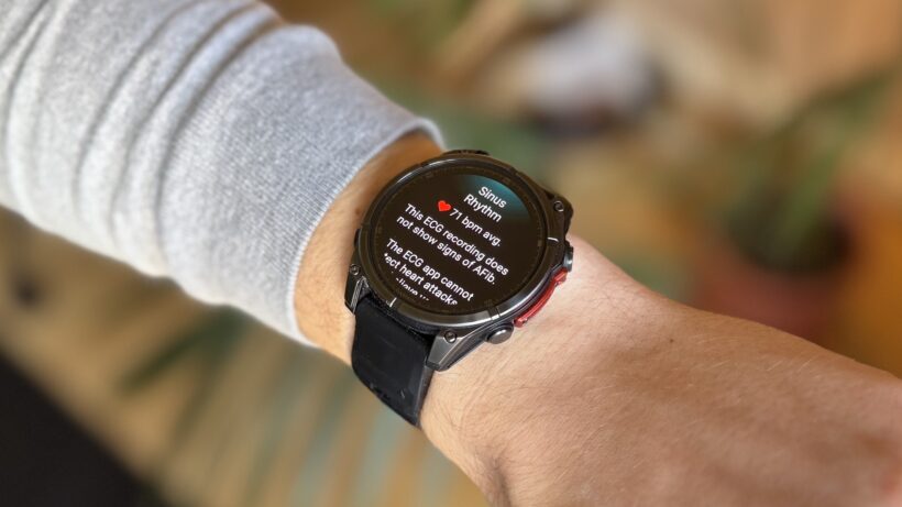 garmin-ecg-sinus